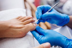Best Shoes For Ingrown Toenails  